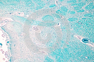 Cerebellum, Thalamus, Medulla oblongata, Spinal cord and Motor Neuron human under the microscope. photo