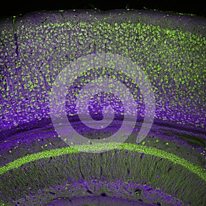 Cerebral cortex and part of the hippocampus photo