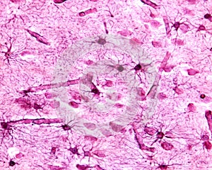 Cerebral cortex. Protoplasmic astrocytes