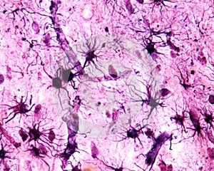 Cerebral cortex. Protoplasmic astrocytes