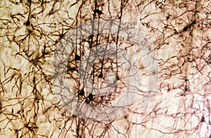 Cerebral cortex. Pyramidal neurons