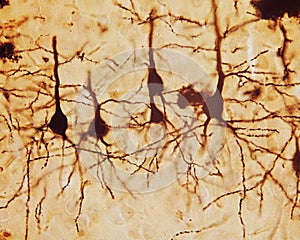 Cerebral cortex. Pyramidal neurons