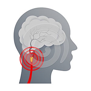 Cerebrovascular disease ischemic icon