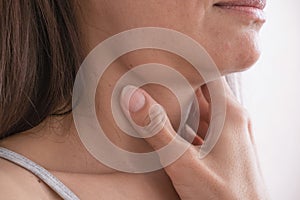 Cervical lymphadenitis of the right side in a woman. photo