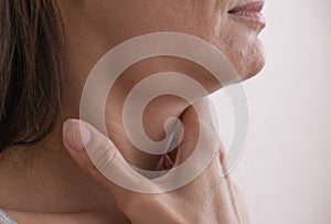 Cervical lymphadenitis of the right side in a woman. photo