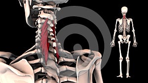 Cervical part of multifidus muscle - real color - 3D model