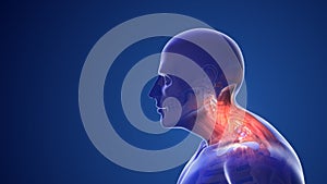 Cervical postural syndrome or neck pain photo