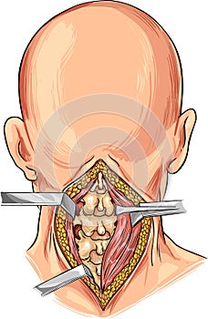 Cervical Spine illustration photo