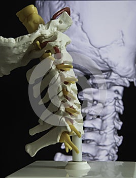 Cervical spine model and MRI picture