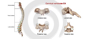 Cervical Vertebrae C4 photo
