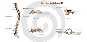 Cervical Vertebrae C1