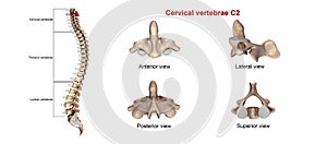 Cervical Vertebrae C2