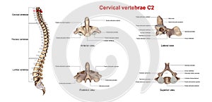 Cervical Vertebrae C2