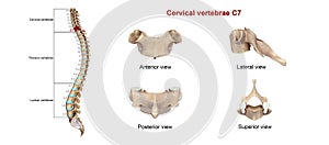 Cervical Vertebrae C7