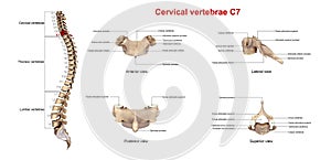 Cervical Vertebrae C7