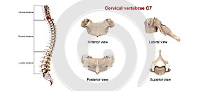 Cervical Vertebrae C7