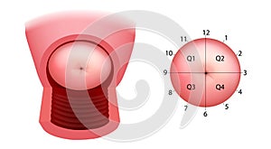 Cervix quadrants and directions. The anatomical position of the cervix. Cervix uteri anatomy. Colposcopy. photo