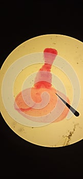 Cestoda scolex under a microscope