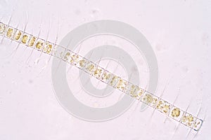 Chaetoceros is the largest genus of marine planktonic diatoms