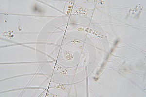 Chaetoceros is marine planktonic diatoms under microscope view