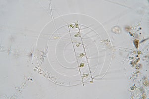 Chaetoceros is marine planktonic diatoms under microscope view