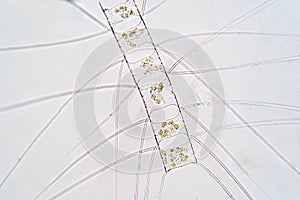 Chaetoceros is marine planktonic diatoms under microscope view