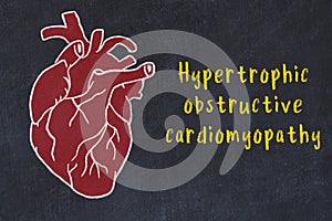 Concept of learning cardiovascular system. Chalk drawing of human heart and inscription Hypertrophic obstructive cardiomyopathy photo