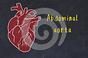Chalk sketch of human heart on black desc and inscription Abdominal aorta
