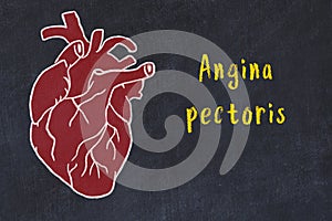 Chalk sketch of human heart on black desc and inscription Angina pectoris