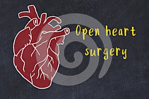 Chalk sketch of human heart on black desc and inscription Open heart surgery