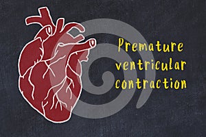 Chalk sketch of human heart on black desc and inscription Premature ventricular contraction