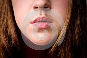 Chapped, or cracked, dry lips that have lost moisture. Woman maintains her lips. Lip Care
