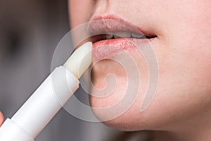 Chapped, or cracked, dry lips that have lost moisture. Woman maintains her lips. Lip Care photo