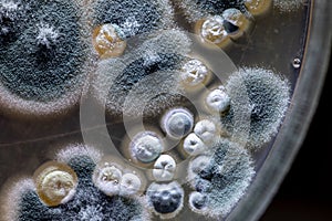 Characteristic of Actinomyces, Bacteria, yeast and Mold on selective media from soil samples for study in laboratory microbiology.