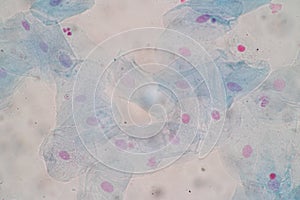Histological sample Squamous epithelial cells under microscope.