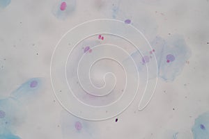 Histological sample Squamous epithelial cells under microscope.