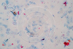 Histological sample Squamous epithelial cells under microscope.