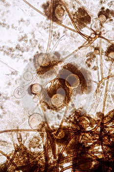 Characteristics of Rhizopus is a genus of common saprophytic fungi on Slide.