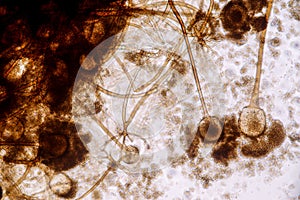 Characteristics of Rhizopus is a genus of common saprophytic fungi on Slide.