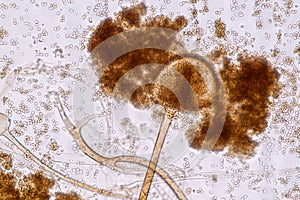 Characteristics of Rhizopus is a genus of common saprophytic fungi on Slide.
