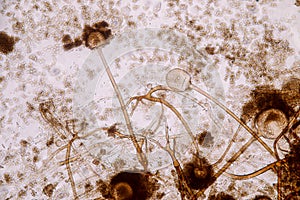 Characteristics of Rhizopus is a genus of common saprophytic fungi on Slide. photo