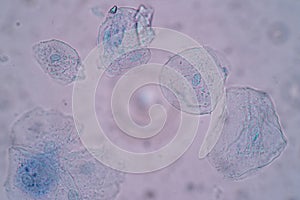 Characteristics of Squamous epithelial cell Cell structure of human under microscope.