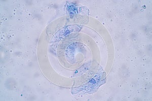 Characteristics of Squamous epithelial cell Cell structure of human under microscope.