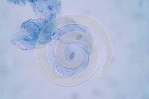Characteristics of Squamous epithelial cell Cell structure of human under microscope.