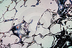 Charcoal dust lung tissue