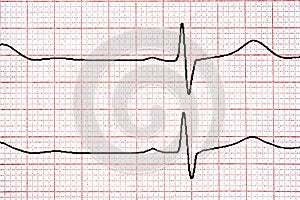 Chart background. Analytic concept.