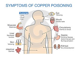 Chart of the Main Symptoms of Copper Poisoning.