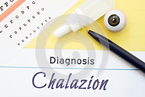 Chart for testing visual acuity, eye drops and eye anatomical model lies next to inscription Diagnosis Chalazion. Concept photo fo photo