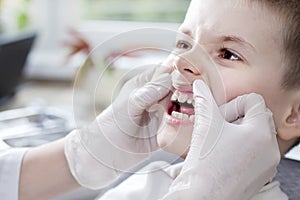 Checking the child`s teeth status. The doctor`s hands in white gloves move the gums and reveal the boy`s white teeth.