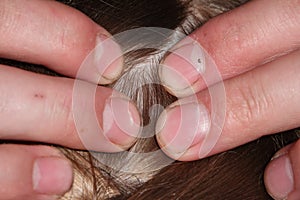 Checking a young girls hair for head lice